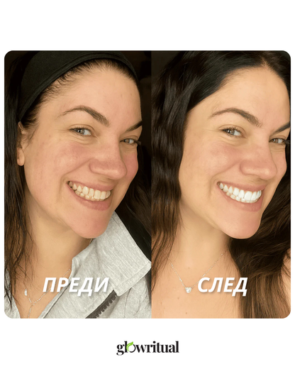 GlowSmile Ленти – Избелващи лентички за зъби